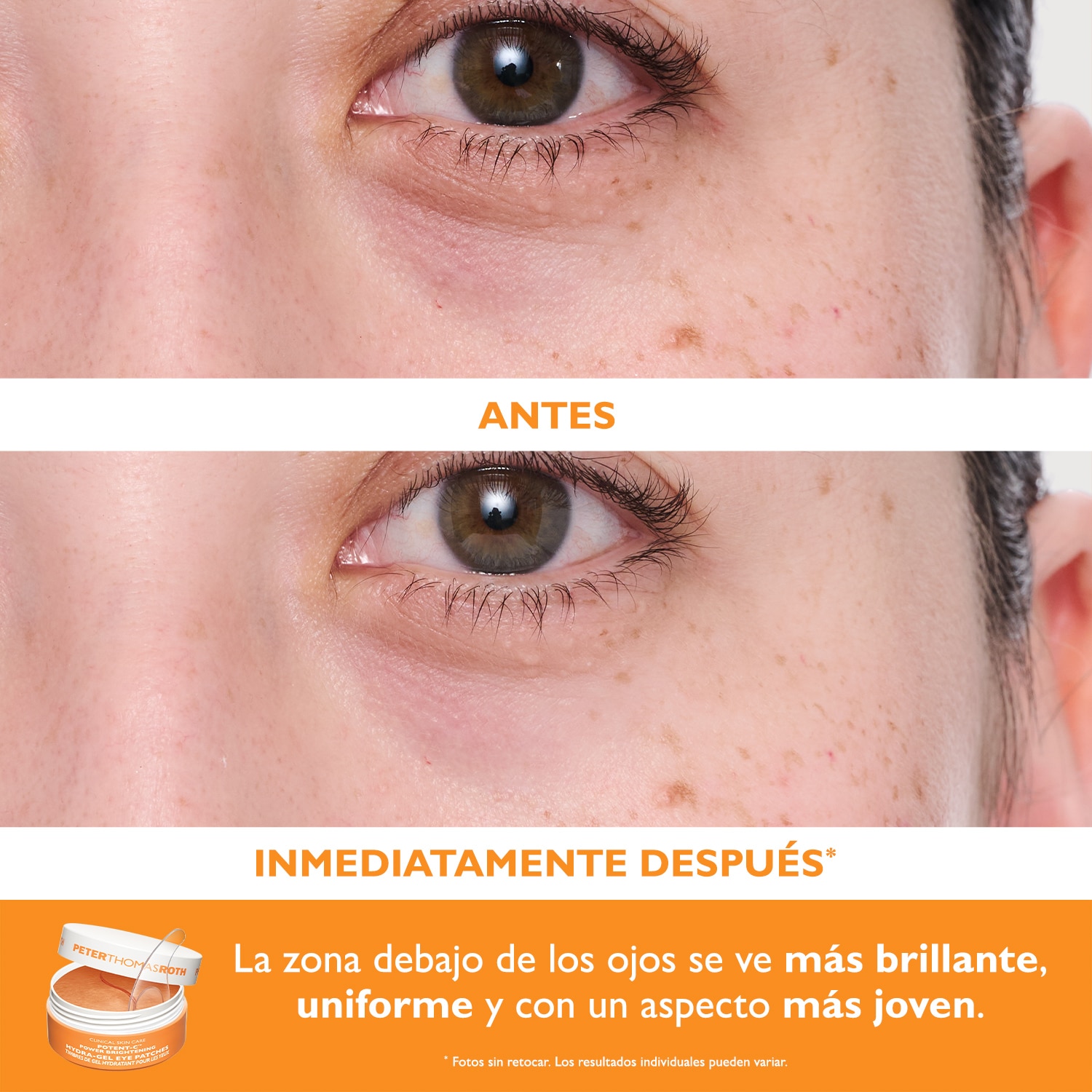 FULL-SIZE VITAMIN C & HYALURONIC EYE PATCHES 2-PIECE KIT (SET DE PARCHES PARA OJOS)